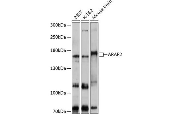ARAP2 Antikörper  (AA 1405-1704)