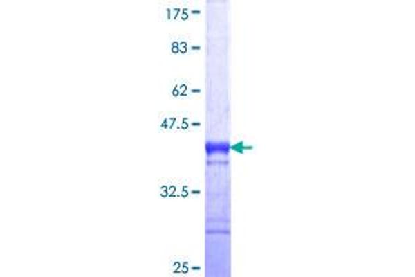 NUP62 Protein (AA 423-522) (GST tag)