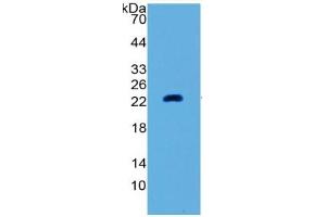 Western Blotting (WB) image for Matrix Metallopeptidase 3 (Stromelysin 1, Progelatinase) (MMP3) ELISA Kit (ABIN6730865)