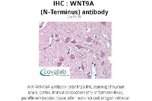 Image no. 1 for anti-Wingless-Type MMTV Integration Site Family, Member 9A (WNT9A) (N-Term) antibody (ABIN1740844) (WNT9A Antikörper  (N-Term))