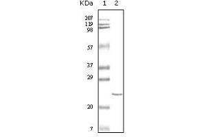 Western blot analysis using cTnI mouse mAb against truncated cTnI recombinant protein. (TNNI3 Antikörper)