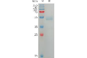 ANGPTL7 Protein (AA 27-346) (His tag)