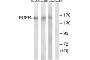 Western blot analysis of extracts from HuvEc/HepG2/HeLa cells, using EGFR (Ab-1071) Antibody. (EGFR Antikörper  (AA 1036-1085))