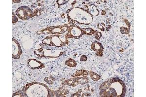 Immunohistochemistry (IHC) image for anti-Keratin 8 (KRT8) (C-Term) antibody (ABIN870549) (KRT8 Antikörper  (C-Term))