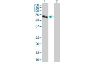 Lane 1: TNFRSF1B transfected lysate ( 48. (TNFRSF1B 293T Cell Transient Overexpression Lysate(Denatured))