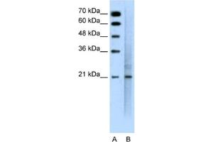 Western Blotting (WB) image for anti-Mucin 1 (MUC1) antibody (ABIN2462410) (MUC1 Antikörper)