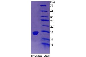 SDS-PAGE analysis of Human PTPMT1 Protein. (PTPMT1 Protein)