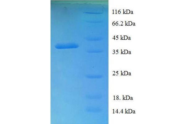 UBXN11 Protein (AA 38-146, partial) (GST tag)