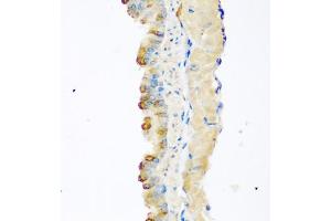 Immunohistochemistry of paraffin-embedded mouse lung using MSTN antibody (ABIN5975443) at dilution of 1/100 (40x lens). (MSTN Antikörper)