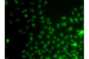 Immunofluorescence analysis of A549 cell using IWS1 antibody. (IWS1 Antikörper)