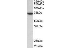 Western Blotting (WB) image for anti-zeta-Chain (TCR) Associated Protein Kinase 70kDa (ZAP70) (Internal Region) antibody (ABIN2465058) (ZAP70 Antikörper  (Internal Region))