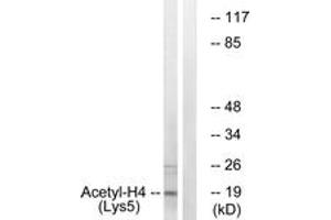 Western blot analysis of extracts from COS7 cells, treated with TSA 400nM 24h, using Histone H4 (Acetyl-Lys5) Antibody. (Histone H4 Antikörper  (acLys5))