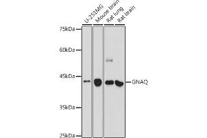 Western blot analysis of extracts of various cell lines, using GNAQ antibody (ABIN7267542) at 1:500 dilution. (GNAQ Antikörper  (AA 1-359))