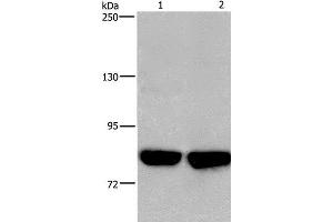 Western Blot analysis of Hela and PC3 cell using PFKP Polyclonal Antibody at dilution of 1:500 (PFKP Antikörper)