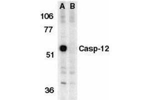 Western blot analysis of Caspase-12 in mouse brain tissue lysate in the absence (A) or presence (B) of blocking peptide with Caspase-12 antibody at 1μg/ml. (Caspase 12 Antikörper  (AA 100-116))