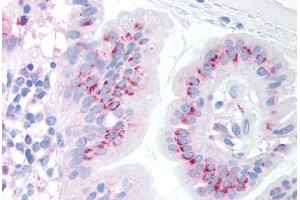 Human Small Intestine (formalin-fixed, paraffin-embedded) stained with BBC3 antibody ABIN213906 at 10 ug/ml followed by biotinylated goat anti-rabbit IgG secondary antibody ABIN481713, alkaline phosphatase-streptavidin and chromogen. (PUMA Antikörper  (C-Term))