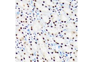 Immunohistochemistry of paraffin-embedded mouse kidney using PBRM1 Rabbit mAb (ABIN1512585, ABIN3020942, ABIN3020943 and ABIN7101308) at dilution of 1:100 (40x lens). (Polybromo 1 Antikörper)