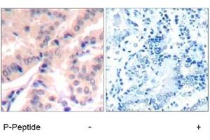 Image no. 1 for anti-Eukaryotic Translation Initiation Factor 4B (EIF4B) (pSer422) antibody (ABIN401564) (EIF4B Antikörper  (pSer422))