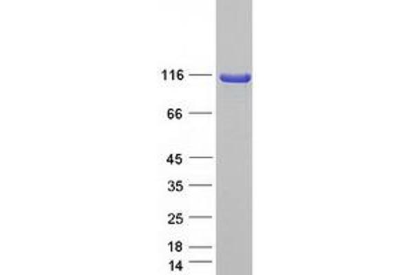 SCYL1 Protein (Transcript Variant B) (Myc-DYKDDDDK Tag)