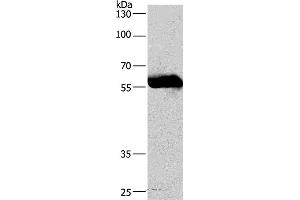 Western blot analysis of Lovo cell , using CORO1C Polyclonal Antibody at dilution of 1:530 (CORO1C Antikörper)