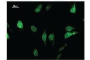 Immunostaining analysis in HeLa cells. (LHX2 Antikörper)