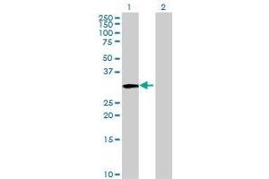 Western Blotting (WB) image for TST 293T Cell Transient Overexpression Lysate(Denatured) (ABIN1333801)