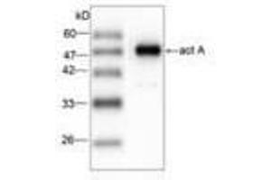 Image no. 1 for anti-Listeria Monocytogenes ActA (AA 117-278) antibody (ABIN791620) (Listeria Monocytogenes ActA (AA 117-278) Antikörper)