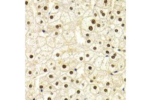 Immunohistochemistry of paraffin-embedded human liver injury using DDB1 Antibody. (DDB1 Antikörper)