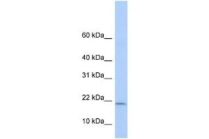 WB Suggested Anti-POLR1D Antibody Titration:  0. (POLR1D Antikörper  (Middle Region))