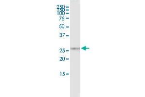 Immunoprecipitation of KIF26A transfected lysate using rabbit polyclonal anti-KIF26A and Protein A Magnetic Bead ( U0007 ), and immunoblotted with mouse purified polyclonal anti-KIF26A. (KIF26A (Human) IP-WB Antibody Pair)