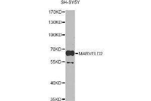 Western blot analysis of extracts of SH-SY5Y cells, using MARVELD2 antibody. (Tricellulin Antikörper)