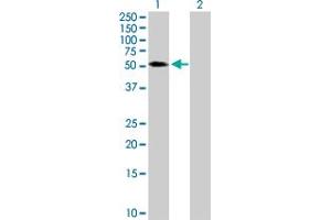 Western Blot analysis of TRIM65 expression in transfected 293T cell line by TRIM65 MaxPab polyclonal antibody. (TRIM65 Antikörper  (AA 1-517))