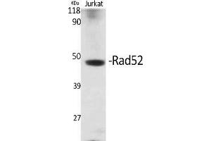 Western Blot analysis of various cells using Rad52 Polyclonal Antibody. (RAD52 Antikörper)