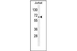 Western blot analysis of RBM14 Antibody (C-term) in Jurkat cell line lysates (35ug/lane). (RBM14 Antikörper  (C-Term))