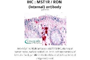 Image no. 1 for anti-Macrophage Stimulating 1 Receptor (C-Met-Related tyrosine Kinase) (MST1R) (Internal Region) antibody (ABIN1737097) (MST1R Antikörper  (Internal Region))