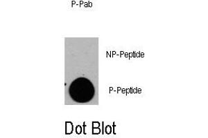 Image no. 1 for anti-Tuberous Sclerosis 2 (TSC2) (pSer1798) antibody (ABIN358410) (Tuberin Antikörper  (pSer1798))