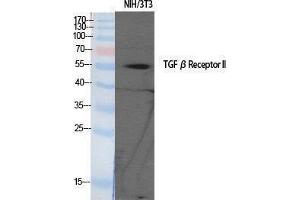 Western Blotting (WB) image for anti-Transforming Growth Factor, beta Receptor II (70/80kDa) (TGFBR2) (Tyr159) antibody (ABIN3177698) (TGFBR2 Antikörper  (Tyr159))