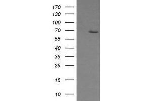 Image no. 2 for anti-Estrogen Receptor 1 (ESR1) antibody (ABIN1498061) (Estrogen Receptor alpha Antikörper)