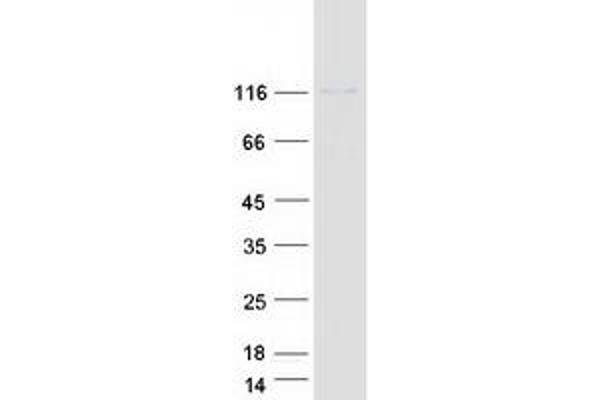 PHKA1 Protein (Transcript Variant 1) (Myc-DYKDDDDK Tag)