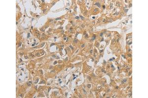 Immunohistochemistry (IHC) image for anti-Hypocretin (Orexin) Receptor 2 (HCRTR2) antibody (ABIN2431739) (HCRTR2 Antikörper)