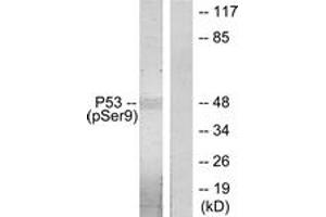 Western Blotting (WB) image for anti-Tumor Protein P53 (TP53) (pSer9) antibody (ABIN2888503) (p53 Antikörper  (pSer9))