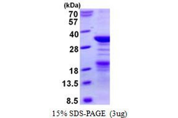 NPM2 Protein (His tag)