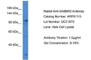 Western Blotting (WB) image for anti-gamma-aminobutyric Acid (GABA) B Receptor, 2 (GABBR2) (C-Term) antibody (ABIN2788680) (GABBR2 Antikörper  (C-Term))
