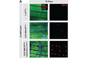 Immunofluorescence (Paraffin-embedded Sections) (IF (p)) image for anti-HIS2AV (pSer137) antibody (ABIN129671)