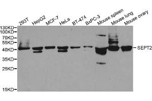 Western blot analysis of extracts of various cell lines, using SEPT2 antibody. (Septin 2 Antikörper)