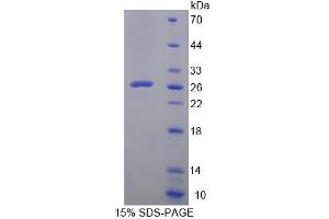 SDS-PAGE (SDS) image for Leupaxin (LPXN) (AA 1-208) protein (His tag) (ABIN6238776) (Leupaxin Protein (LPXN) (AA 1-208) (His tag))