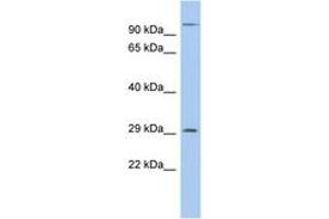 Image no. 1 for anti-Kv Channel Interacting Protein 2 (KCNIP2) (AA 35-84) antibody (ABIN6742555) (KCNIP2 Antikörper  (AA 35-84))