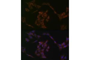 Immunofluorescence analysis of C6 cells using IRF6 Rabbit mAb (ABIN1680921, ABIN3017588, ABIN3017589 and ABIN7101507) at dilution of 1:100 (40x lens). (IRF6 Antikörper)