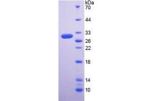 SDS-PAGE (SDS) image for Regucalcin (RGN) (AA 65-299) protein (His tag) (ABIN6237809) (Regucalcin Protein (RGN) (AA 65-299) (His tag))