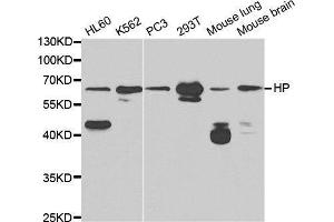 Western blot analysis of extracts of various cell lines, using HP antibody. (Haptoglobin Antikörper)